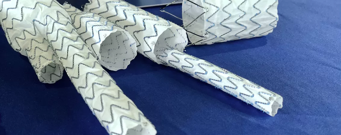 Model medical cu stent graft utilizat in tratamentul endovascular al aortei