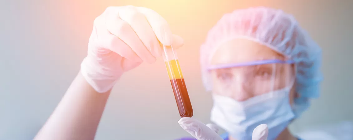 Proba de plasma imbogatita cu trombocite pregatita pentru tratament regenerativ