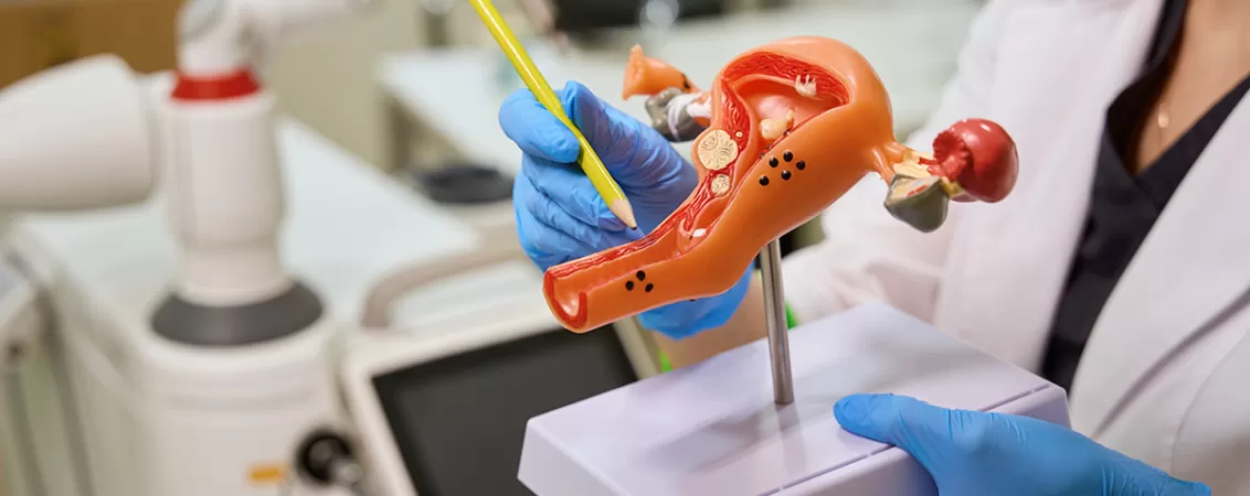 Un ginecolog care foloseste un model al uterului in timpul unei consultatii
