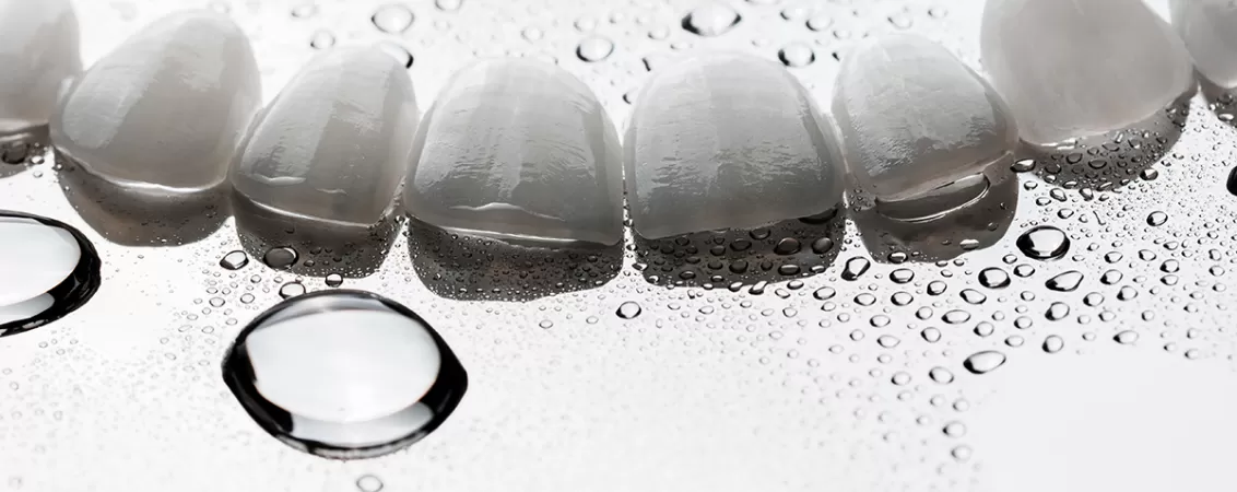 Fatete dentare ceramice.