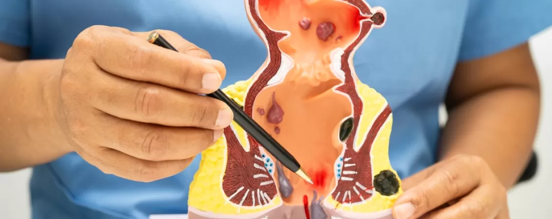 Medic care prezinta anatomia rectului