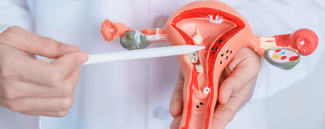 Medic prezinta un model anatomic al uterului si ovarelor in timpul consultatiei medicale