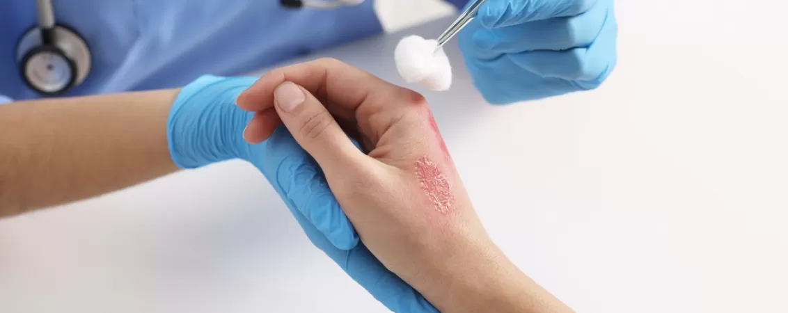 Medic trateaza o arsura la nivelul mainii in timpul unei consultatii medicale