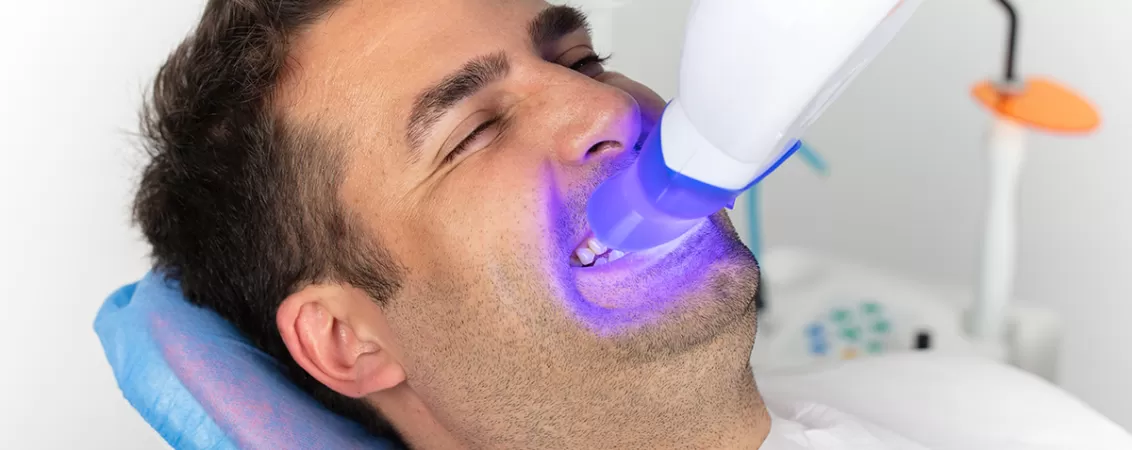Procedura de albire dentara la cabinetul stomatologic
