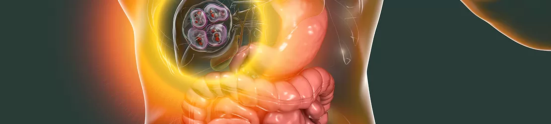 chist hidatic la nivelul ficatului