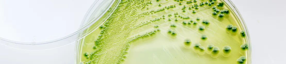 cultura de Vibrio cholerae