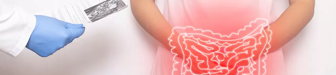 medic in timpul unei consultatii a unei paciente cu diverticuloza