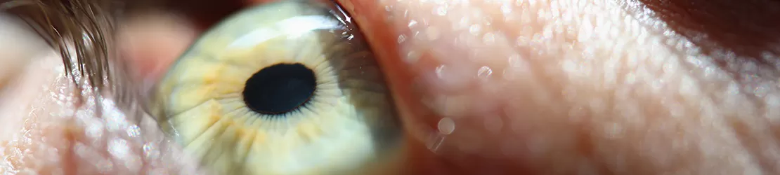 Informatii despre dezlipirea de retina