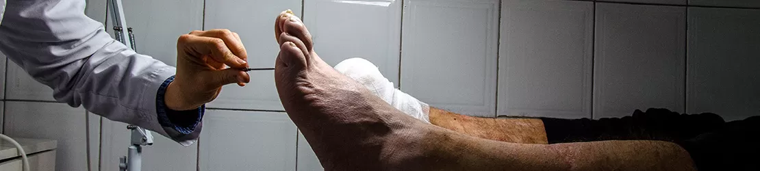 medic in timpul unui consult medical al unui pacient cu simptome de polineuropatie