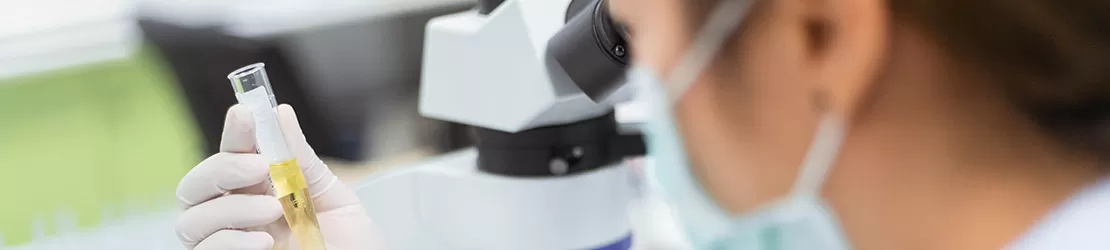 tehnician de laborator analizand proba de urina a unui pacient cu anurie