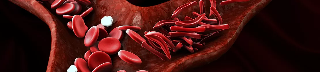 Anemia hemolitica si globulele rosii