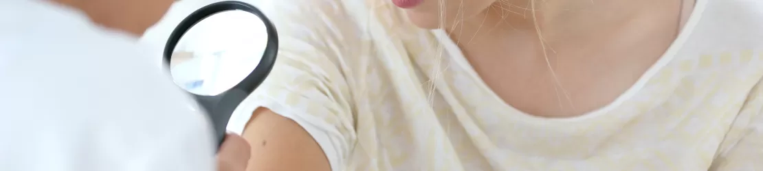 Femeie la control dermatologic pentru pitiriazis alba