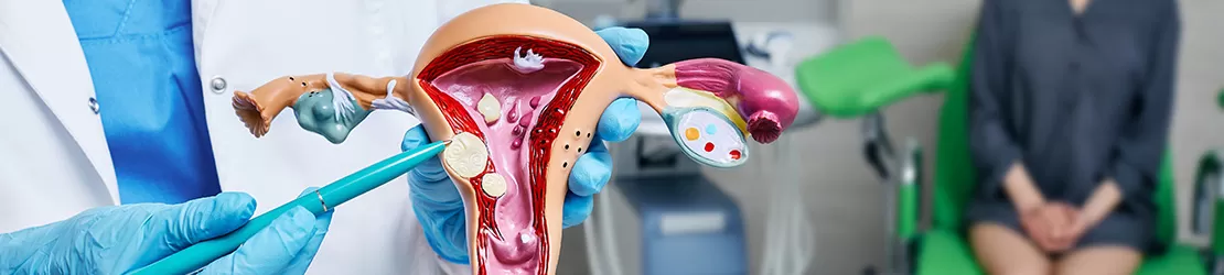 Informatii generale despre leiomiomul uterin