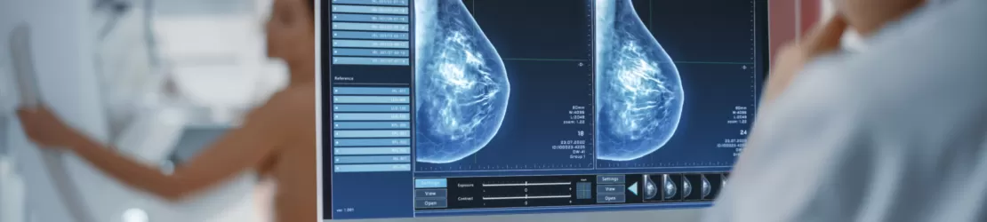 Mamografie pentru detectarea calcifierilor la nivel de san