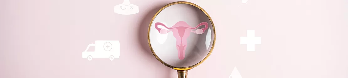 Simptome ale leiomiomului uterin