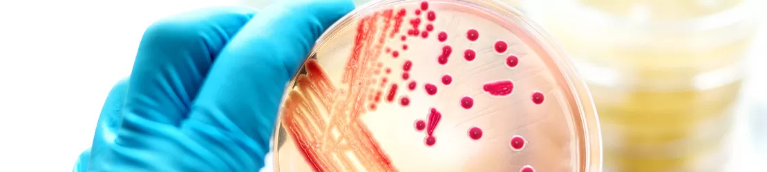 Cultura de bacterii cu potential de a cauza infectii si septicemie