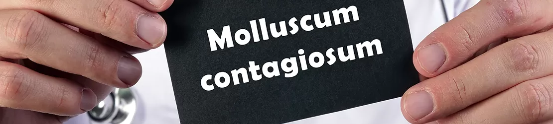 doctor dermatolog tine un bilet pe care scrie Molluscum Contagiosum