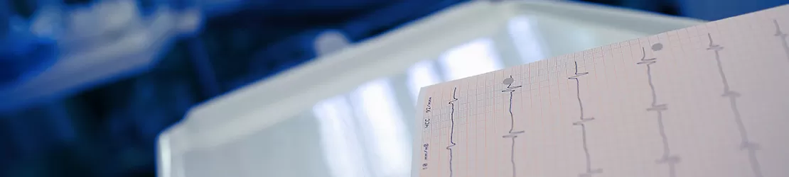 Electrocardiograma intr-un salon medical