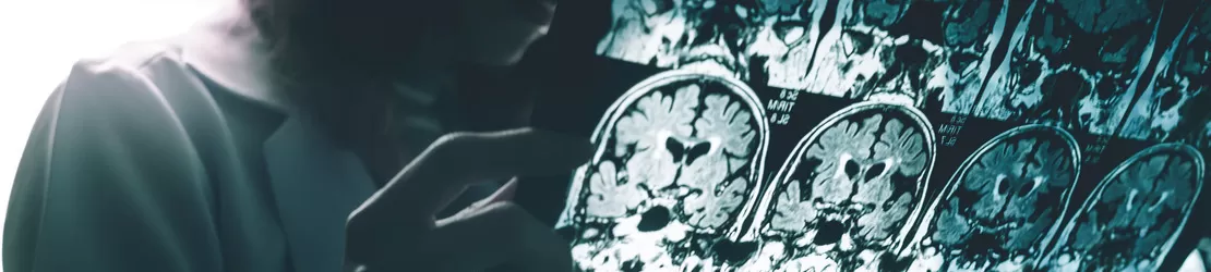 medic neurolog studiaza un ct