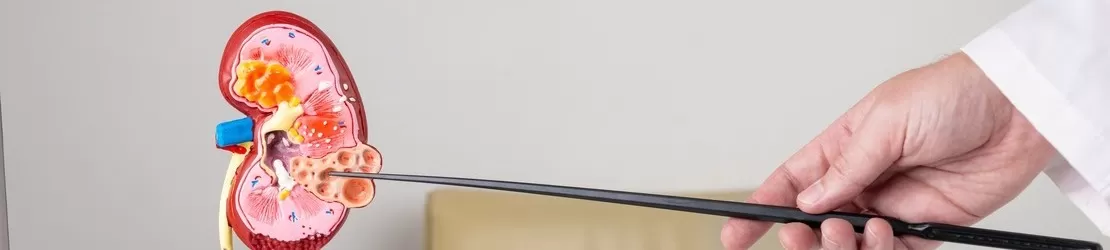 personal medical analizand macheta rinichiului uman polichistic