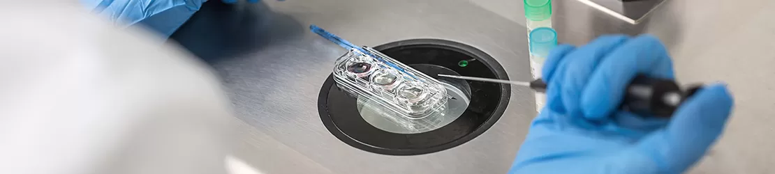 Personal medical care verifica o proba la microscop