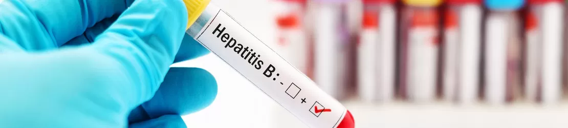 proba se sange pozitiva pentru virusul hepatitei B