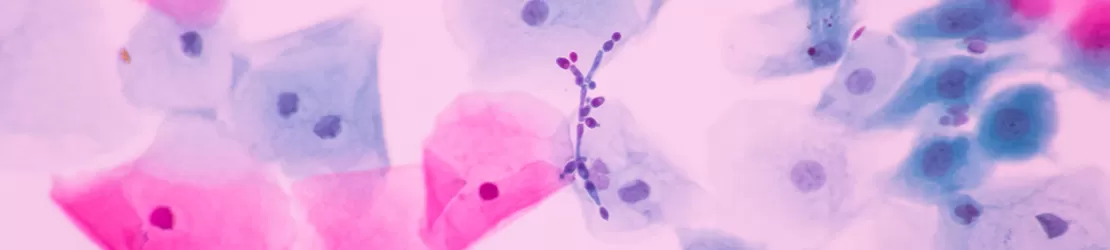Ciuperca ce determina candidoza vaginala, la microsop