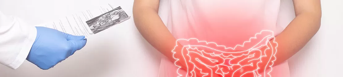 Un medic verifica dosarul unei paciente care sufera de megacolon