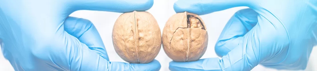 Ilustrare a conceptului de cancer testicular