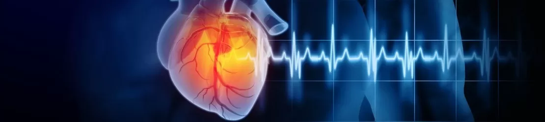 ilustratie a atacului de cord sau a unei boli cardiovasculare