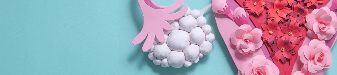 Reprezentare conceptuala a ovarului polichistic