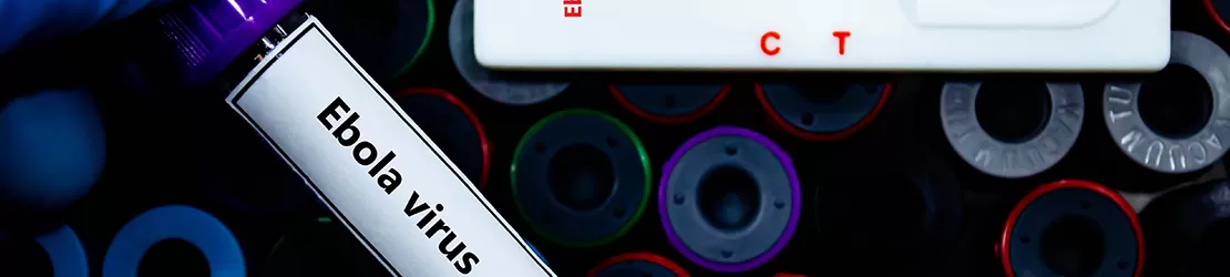 Test negativ pentru depistarea virusului ebola