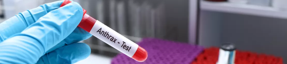 Proba de sange pentru diagnosticarea bolii antrax