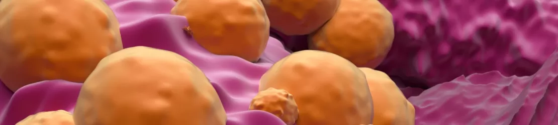 Reprezentare 3D pentru carcinomul bazocelular