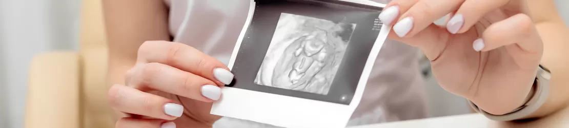 Medic aratandu-i o ecografie unei paciente care urmeaza sa fie diagnosticata cu chist naboth