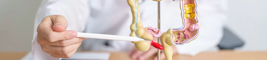 Medic aratand spre un model al anatomiei colonului