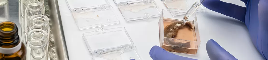 Specialist testand o proba pentru botulism in laborator