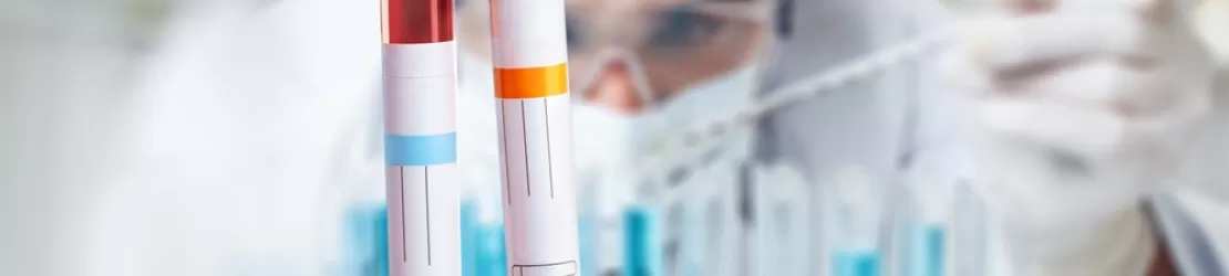 Proba de sange pentru testarea nivelului de potasiu din sange