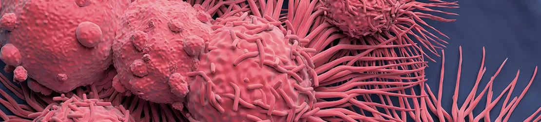 Reprezentare microscopica pentru celule canceroase