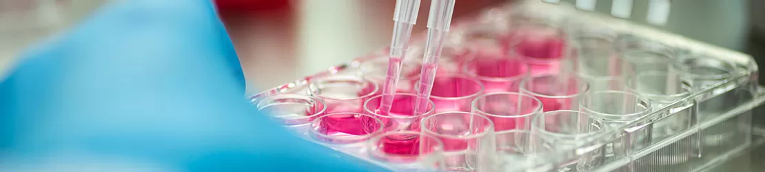 Cercetator in laborator efectuand analiza genetica a celulelor cu ajutorul unei microplaci