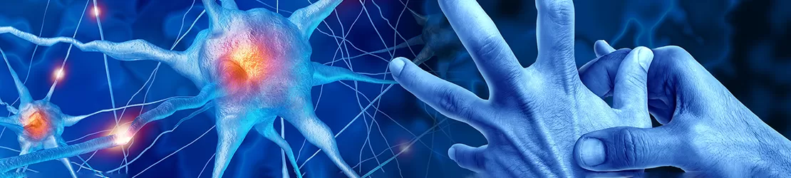 Reprezentare grafica pentru bradikinezie