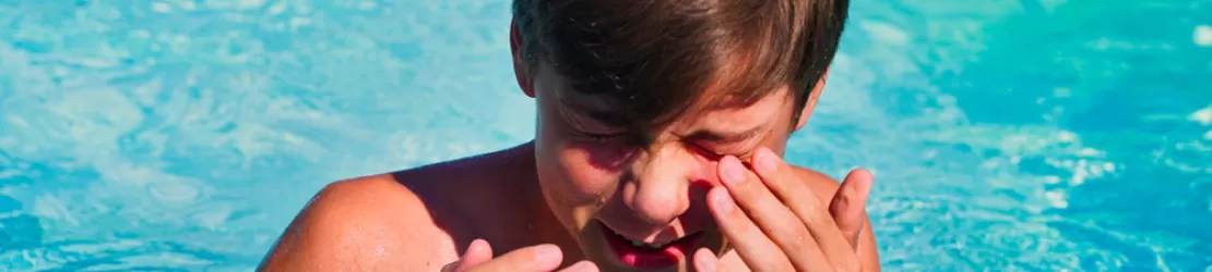 Baiat adolescent intr-o piscina stergandu-se la ochi si prezentand simptome de alergie la apa