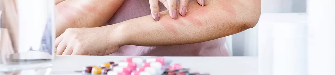 Femeie care se scarpina pe brat din cauza unei reactii alergice la medicamente