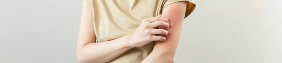 Femeie care sufera de iritatie la nivelul mainii