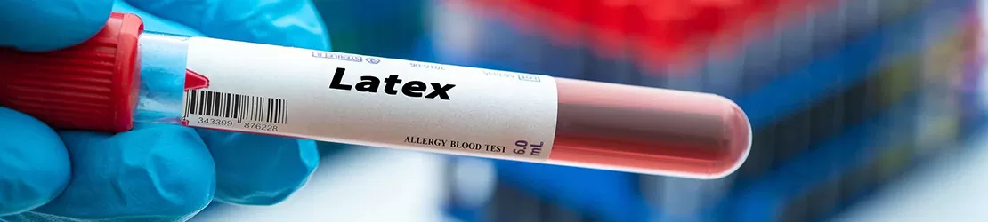 Proba de sange pentru testul de alergie la latex