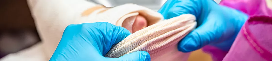 Asistenta medicala panseaza piciorul unui pacient cu epidermoliza buloasa