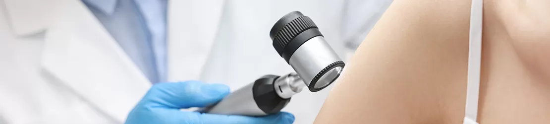 Dermatolog examineaza pielea unui pacient cu ajutorul unui dermatoscop intr-un cabinet medical