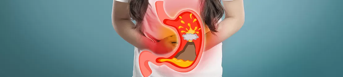 Femeie care sufera de arsuri gastrice