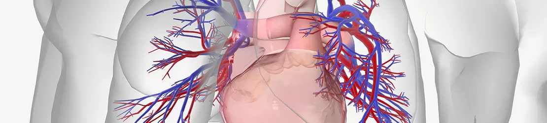 Reprezentarea grafica a hipertensiunii pulmonare, evidentiind inima si plamanii in sectiune