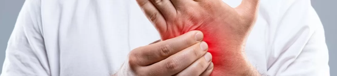 Mana unui barbat cu piele iritata si cu semne de dermatita sau eczema, afectiune inflamatorie vizibila pe maini